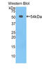 Protein C, Inactivator Of Coagulation Factors Va And VIIIa antibody, LS-C296096, Lifespan Biosciences, Western Blot image 