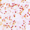 Histone H3-like centromeric protein A antibody, GTX56223, GeneTex, Immunohistochemistry paraffin image 