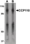 Centrosomal protein CP110 antibody, PA5-34380, Invitrogen Antibodies, Western Blot image 