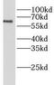 Hepatic lipase antibody, FNab04794, FineTest, Western Blot image 