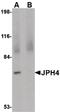 Junctophilin 4 antibody, PA5-20645, Invitrogen Antibodies, Western Blot image 