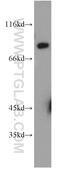 Sodium Channel Epithelial 1 Gamma Subunit antibody, 13943-1-AP, Proteintech Group, Western Blot image 