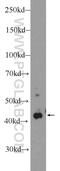 Platelet Derived Growth Factor Receptor Like antibody, 16217-1-AP, Proteintech Group, Western Blot image 