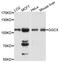 Gamma-Glutamyl Carboxylase antibody, STJ111114, St John