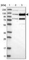 Zinc Finger Protein 592 antibody, PA5-54180, Invitrogen Antibodies, Western Blot image 