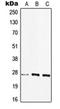 Major Histocompatibility Complex, Class II, DQ Beta 2 antibody, orb215475, Biorbyt, Western Blot image 