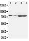 Proprotein Convertase Subtilisin/Kexin Type 9 antibody, PA2130, Boster Biological Technology, Western Blot image 