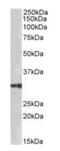 Hydroxysteroid 17-Beta Dehydrogenase 3 antibody, orb318744, Biorbyt, Western Blot image 