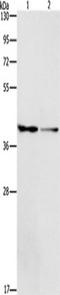 Lysosomal acid phosphatase antibody, TA350730, Origene, Western Blot image 