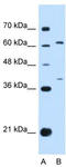 Interferon Lambda Receptor 1 antibody, TA346514, Origene, Western Blot image 