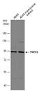 Transient Receptor Potential Cation Channel Subfamily C Member 6 antibody, GTX113858, GeneTex, Western Blot image 