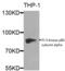 Phosphatidylinositol 3-kinase regulatory subunit alpha antibody, AHP2508, Bio-Rad (formerly AbD Serotec) , Western Blot image 