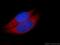 Cast antibody, 12250-1-AP, Proteintech Group, Immunofluorescence image 