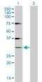 Histone Cluster 1 H1 Family Member A antibody, H00003024-D01P, Novus Biologicals, Western Blot image 