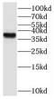 Rhox Homeobox Family Member 2 antibody, FNab07288, FineTest, Western Blot image 