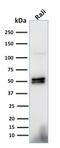 CD79a antibody, GTX34564, GeneTex, Western Blot image 
