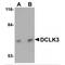 Doublecortin Like Kinase 3 antibody, MBS151422, MyBioSource, Western Blot image 