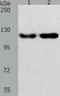 ABL Proto-Oncogene 2, Non-Receptor Tyrosine Kinase antibody, TA323875, Origene, Western Blot image 