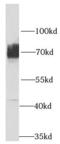 Neutral amino acid transporter A antibody, FNab07916, FineTest, Western Blot image 