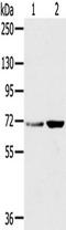 Sorting Nexin 2 antibody, TA351734, Origene, Western Blot image 