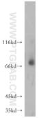 Matrix Metallopeptidase 8 antibody, 17874-1-AP, Proteintech Group, Western Blot image 