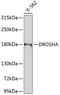 Drosha Ribonuclease III antibody, 23-518, ProSci, Western Blot image 