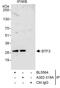 Basic Transcription Factor 3 antibody, A302-319A, Bethyl Labs, Immunoprecipitation image 