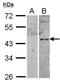 VIPR2 antibody, GTX100324, GeneTex, Western Blot image 
