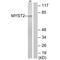 Lysine Acetyltransferase 7 antibody, A03896, Boster Biological Technology, Western Blot image 