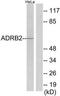 ADRB2 antibody, TA313385, Origene, Western Blot image 