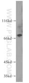 Tensin 4 antibody, 11580-1-AP, Proteintech Group, Western Blot image 