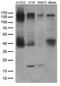 FGFR-2 antibody, M00231-1, Boster Biological Technology, Western Blot image 