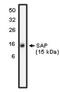 SH2 Domain Containing 1A antibody, orb108835, Biorbyt, Western Blot image 