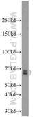G-Patch Domain Containing 2 antibody, 24366-1-AP, Proteintech Group, Western Blot image 