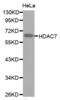 Histone Deacetylase 7 antibody, abx002162, Abbexa, Western Blot image 