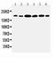 Laminin Subunit Gamma 1 antibody, LS-C312737, Lifespan Biosciences, Western Blot image 