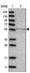 Multiple inositol polyphosphate phosphatase 1 antibody, NBP1-82644, Novus Biologicals, Western Blot image 