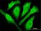 Cytoglobin antibody, H00114757-M02, Novus Biologicals, Immunocytochemistry image 