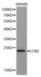 Lipocalin 2 antibody, abx001704, Abbexa, Western Blot image 