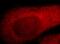 Thymidylate Synthetase antibody, FNab08681, FineTest, Immunofluorescence image 