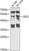 Leucine Rich Alpha-2-Glycoprotein 1 antibody, 23-228, ProSci, Western Blot image 