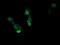 RCAN Family Member 3 antibody, NBP2-45928, Novus Biologicals, Immunofluorescence image 