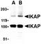 Elongator Complex Protein 1 antibody, orb74429, Biorbyt, Western Blot image 