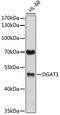 Diacylglycerol O-acyltransferase 1 antibody, 22-510, ProSci, Western Blot image 