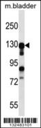 Myocardin Related Transcription Factor B antibody, 56-773, ProSci, Western Blot image 