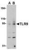 Toll Like Receptor 9 antibody, TA306290, Origene, Western Blot image 