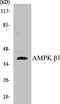 Protein Kinase AMP-Activated Non-Catalytic Subunit Beta 1 antibody, EKC1026, Boster Biological Technology, Western Blot image 