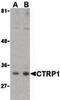 C1q And TNF Related 1 antibody, LS-C19516, Lifespan Biosciences, Western Blot image 