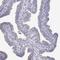 Ankyrin Repeat Domain 65 antibody, NBP2-39062, Novus Biologicals, Immunohistochemistry frozen image 