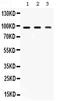 Argonaute RISC Catalytic Component 2 antibody, PA5-78738, Invitrogen Antibodies, Western Blot image 